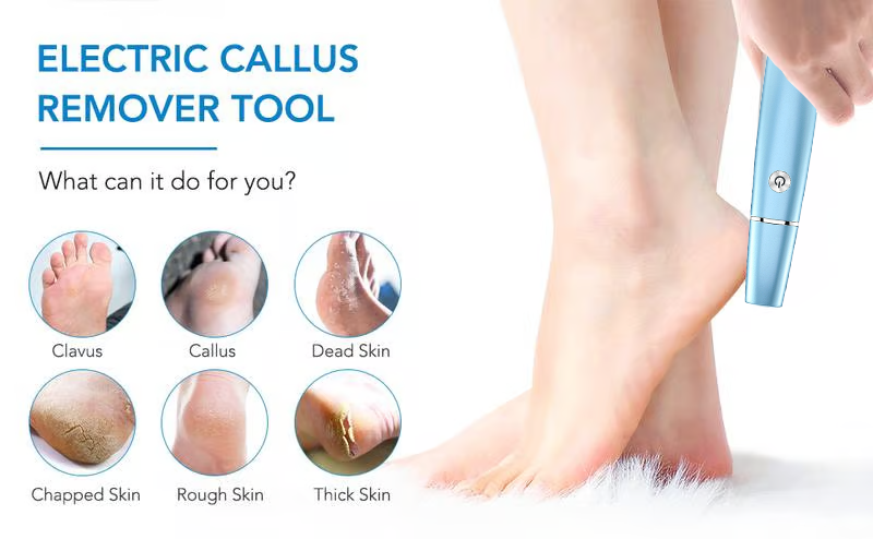 🔥Electric Feet Callus Remover