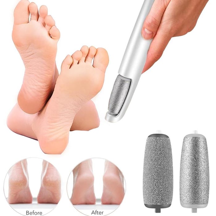 🔥Electric Feet Callus Remover